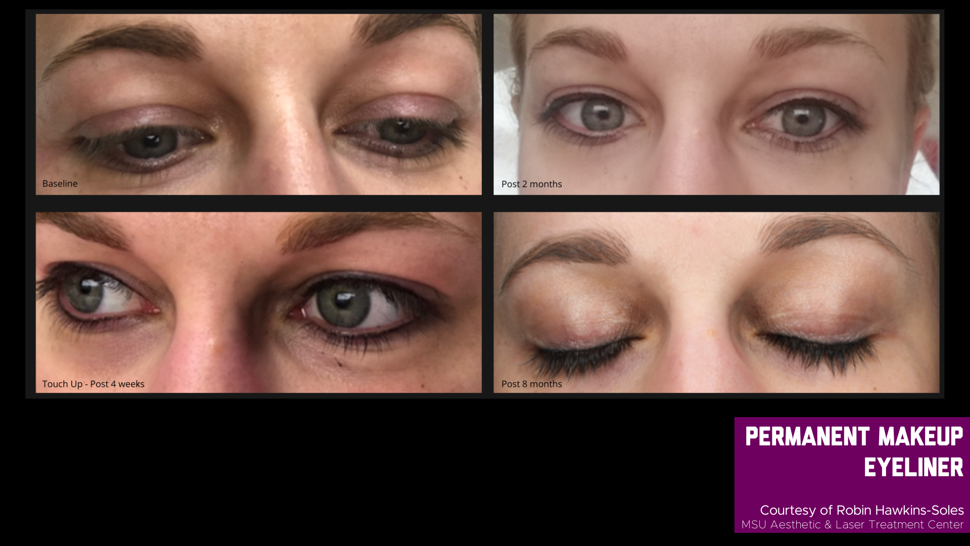 before and after treatment photos